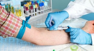 suitsetamine ja veenist vereanalüüsi võtmine